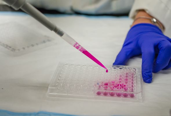 Rat Myoglobin ELISA kit